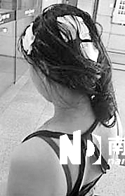 <p>    傷者頭部被砸出多個(gè)血洞。 通訊員杜亞軍南都記者徐文閣 攝</p>