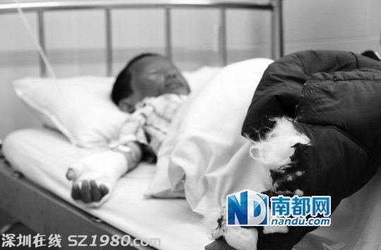 東莞三孩童撿來個(gè)氫氣球 忽然爆炸二級(jí)燒傷