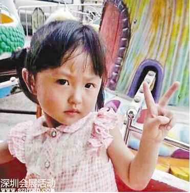 女孩跌進熱油桶 父親脫其衣服揭掉表皮致二次傷害