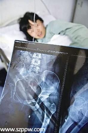 女子娘家陽臺(tái)遭槍擊