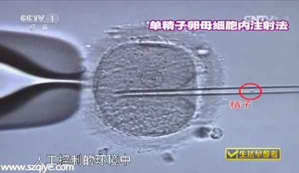 億萬(wàn)富婆戀上醫(yī)生試管造人 5年后又冒出代孕兒子