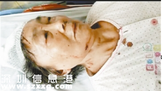 <a href=http://www.zshb029.com/shenzhen/ target=_blank class=infotextkey>深圳</a>(www.zshb029.com)一超市扶梯抖不停致7旬老人摔落重傷 家屬商場各執(zhí)一詞
