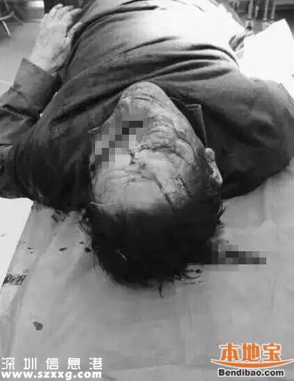 安徽醫(yī)生被砍死 事發(fā)時醫(yī)生正在睡覺