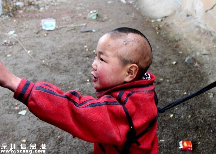 兄妹倆被拴豬圈邊 腦癱兄妹無(wú)錢(qián)治病好心塞(圖)