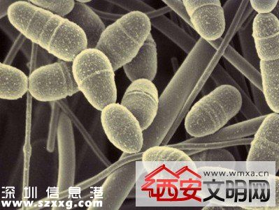 美國發(fā)現(xiàn)無敵細菌無藥可治 若擴散人類或?qū)⒃馐軠珥斨疄? width=
