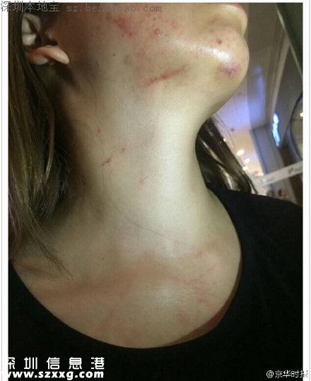 深圳女子稱報(bào)案被毆打 警察回應(yīng)酒后辱罵民警