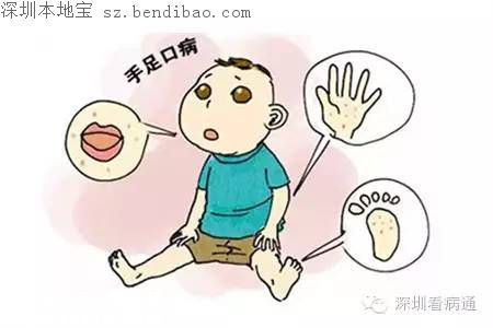 深圳手足口病疫苗來(lái)了！寶安鹽田南山開(kāi)始供應(yīng)