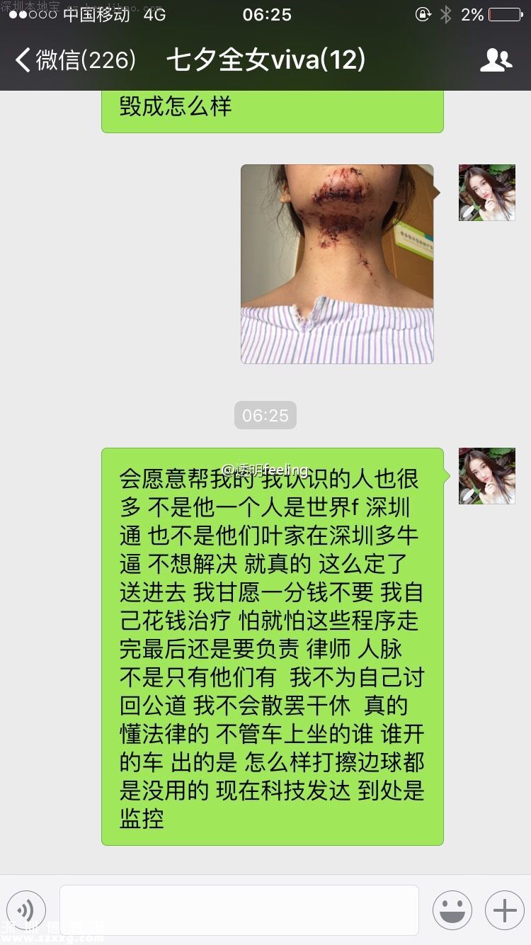 深圳女子乘豪車被毀容 肇事司機(jī)涉嫌頂包酒駕